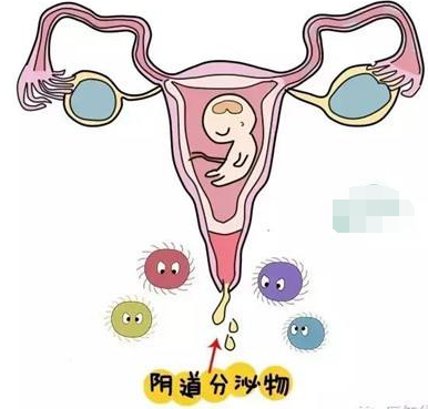 阴道分泌物91视频在线看的一般性状检查类型