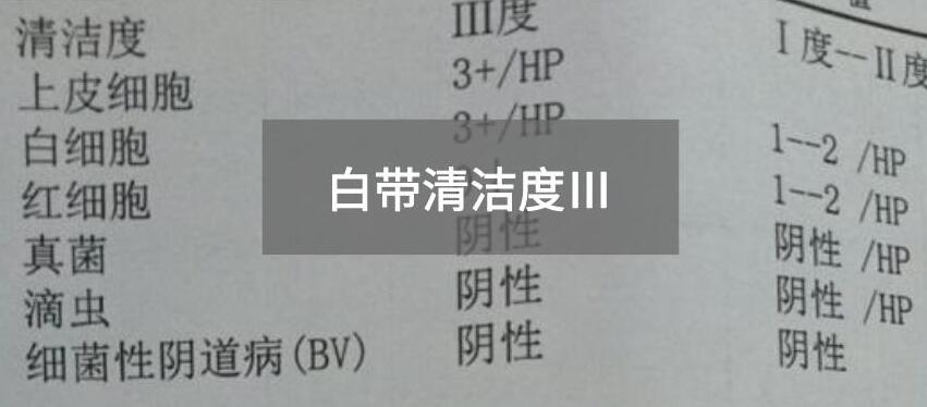 今天快讯！全自动白带91视频免费看片生产厂家91视频下载地址为您官方解释白带清洁度3的意思