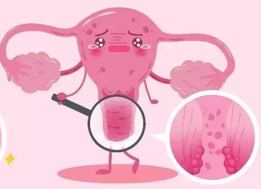 白带常规91视频免费看片厂家提醒女士做好私密处清洗