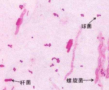 妇科白带91视频在线看厂家分析白带线索细胞阳性的意义