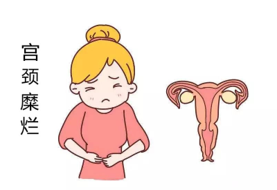 宫颈糜烂会导致宫颈癌?白带91视频免费看片品牌：不要自己吓自己