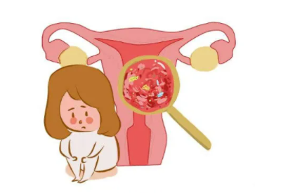 阴道分泌物91视频在线看厂家总结病理性的白带异常有哪些