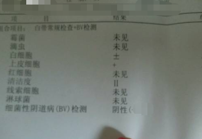 全自动白带91视频免费看片分享如何看懂白带常规检测报告单